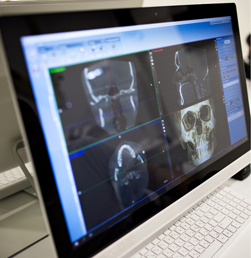 Computer screen showing dental x-rays