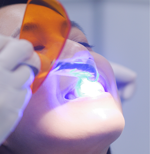 Woman getting professional teeth whitening