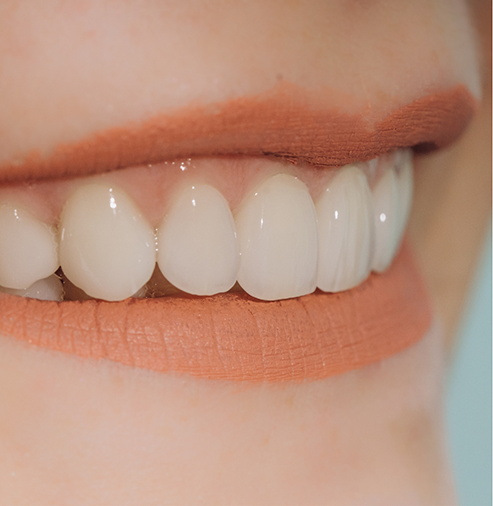 Close up of a smile with flawless teeth