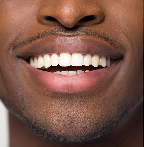 Close up of a man smiling with flawless teeth