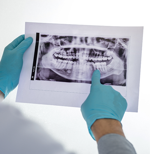 Dentist looking at x-rays of teeth