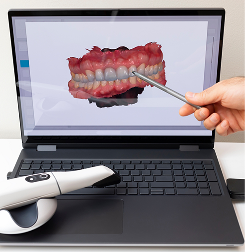 Dentist looking at digital scans of a patient's teeth