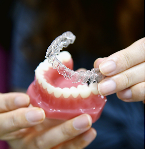 Dentist placing Invisalign over a model of the teeth