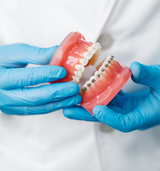 Orthodontist holding a model of the teeth with braces