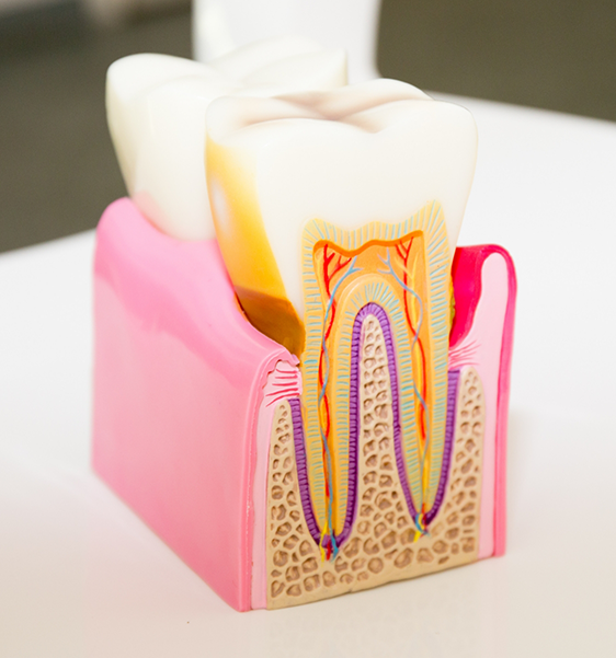 Model of a tooth showing the root canals inside of it