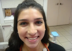 Dentist Alexandria VA Invisalign After Smile