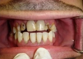 Dentist Alexandria VA Case Study 19 Before