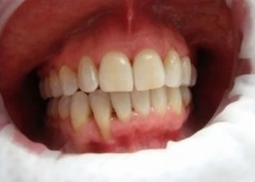 Dentist Alexandria VA Case Study 2 After