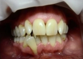 Dentist Alexandria VA Case Study 2 Before