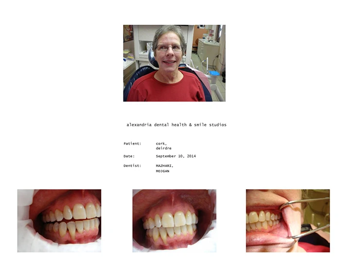 Dentist Alexandria VA Case Study 22 After