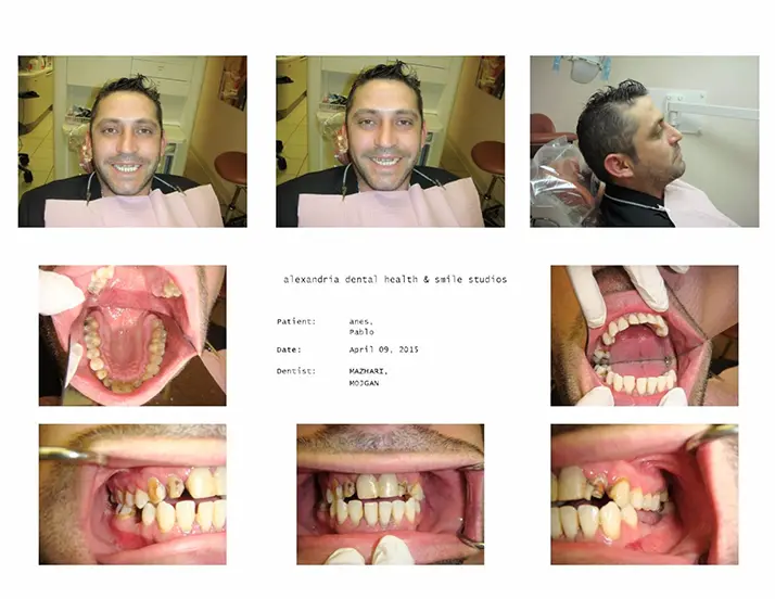 Dentist Alexandria VA Case Study 23