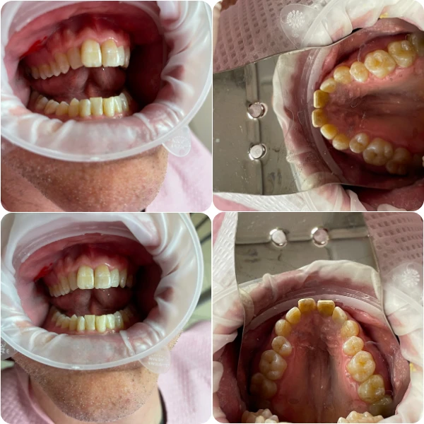 Dentist Alexandria VA Case Study 27 Before