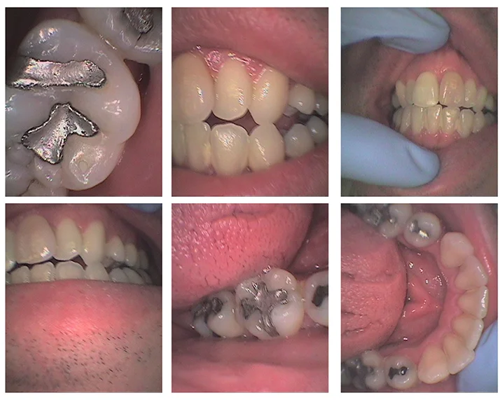 Dentist Alexandria VA Case Study 31 Before