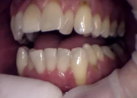 Dentist Alexandria VA Case Study 33 Before