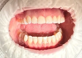 Dentist Alexandria VA Case Study 45 Before