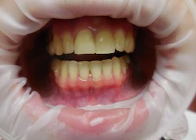 Dentist Alexandria VA Case Study 47 Before