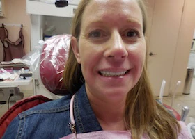 Dentist Alexandria VA Case Study 47 Portrait After