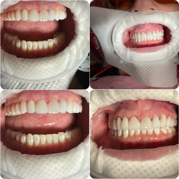 Dentist Alexandria VA Case Study 7 After