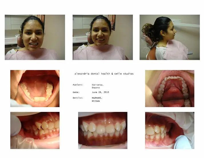 Dentist Alexandria VA Case Study 8 Before